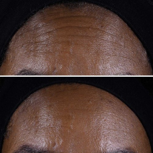 CLINIQUE-Smart Clinical Repair - Crème Liftante Visage + Cou CLINIQUE-Smart Clinical Repair - Crème Liftante Visage + Cou